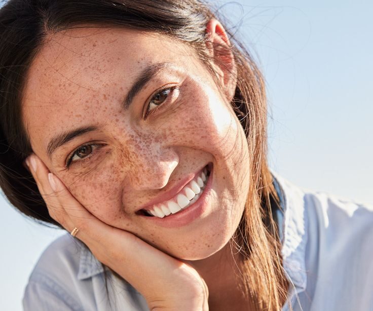 dental veneers