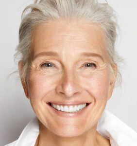 sutton woman smiling with white teeth and dental implants