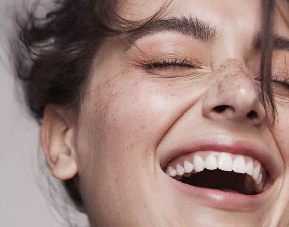 sutton woman smiling with white teeth and dental implants
