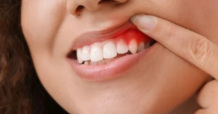 dental emergency in belmont sutton woman with white teeth in tooth pain