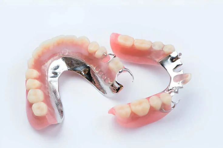 metal partial dentures white teeth white smile in belmont sutton dentist