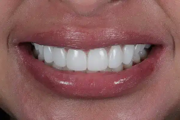 After